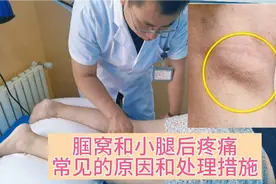 腘窝和小腿后疼痛，临床上常见的原因和处理措施！