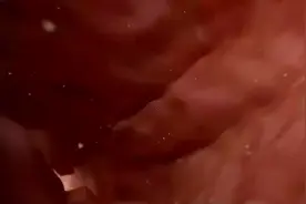 近距离看子宫颈,感受生命的奇迹