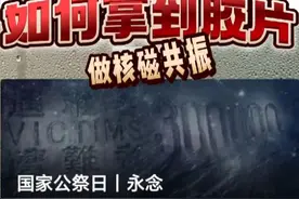 如何把医院拍的片子变成电子版