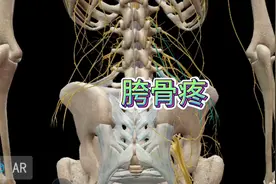 臀上皮神经损伤，胯骨上沿疼痛，原因和方法