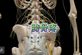 臀上皮神经损伤，胯骨上沿疼痛，原因和方法视频封面
