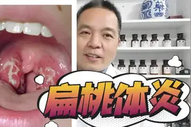 春天上火易闹嗓子，一个针对小儿扁桃体炎的中成药视频封面