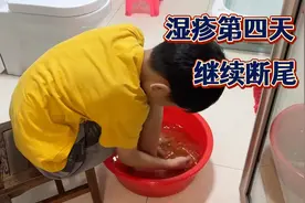 湿疹第四天基本上开始淡化掉痂了：换了健脾祛湿汤晚上睡觉踏实了