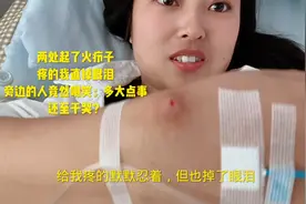 谁知道火疖子是啥原因引起的？另一处比核桃还要大，疼哭我了视频封面