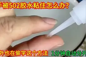 手指被502胶水粘住，老外也在偷学这个方法，1分钟自动打开！视频封面