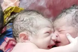 罕见的三胞胎惊险降生！放到一起后，搞笑的事情开始了视频封面