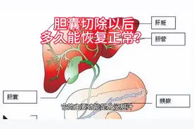 胆囊切除以后，多久能恢复正常？视频封面