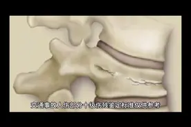 交通事故人伤部分十级伤残鉴定标准仅供参考视频封面