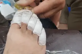 快来看我为美女修脚🦶，修脚大师，不一样的青春年华。我们不一样