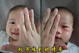 小宇被蚊子咬到眼睛旁，眼睛肿了。阿东好心疼，小冰好自责