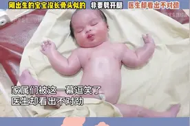 刚出生宝宝劈腿动作，医生一眼看出不对劲，家长惊呆了！