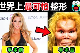 世界上最可怕的整形失败！10个“过度整形”明星，男友当场被吓尿视频封面