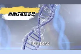 眼距过宽综合征