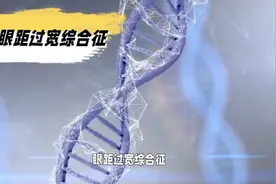 眼距过宽综合征视频封面