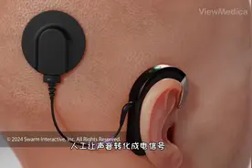 人工耳蜗的原理，儿童为什么需要早点植入，3D演示。。视频封面
