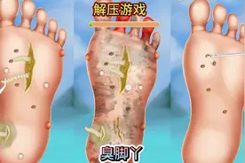 解压游戏之沉浸式清理脚丫子～
