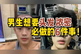 男生想要头发浓密必做的6件事，尤其最后一件！