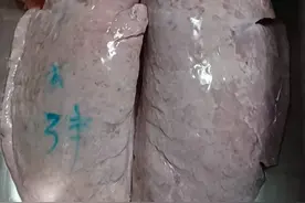 南北杏煲猪肺汤，咳嗽汤水。视频封面