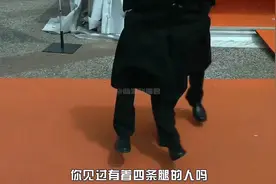 盘点人体怪异现象，连体人，还有着四条腿的人，看看你见过哪些？视频封面