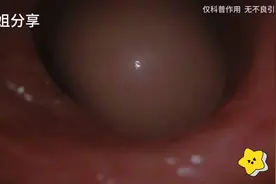 胎儿在妈妈肚子里是什么样子呢，看看这个视频，让你了解更多知识视频封面