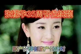 张檬自曝孕35周臀位绕颈，羊水曾告急，后续咋应对？视频封面