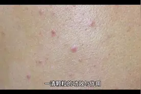 一清颗粒的功效与作用视频封面