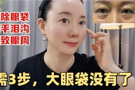 如何去除眼袋？只需3步，消除眼袋抚平泪沟，眼纹也淡化了视频封面