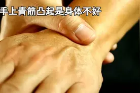 青筋凸起原因：为何你的手掌会现“生命线，专家告诉你答案视频封面