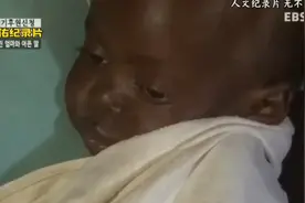 （二）非洲1岁女童患怪病，肚子大得像皮球，最后还是离世了视频封面