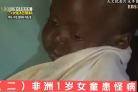 （二）非洲1岁女童患怪病，肚子大得像皮球，最后还是离世了视频封面