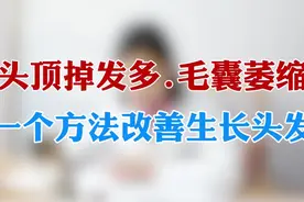 头顶掉发多，毛囊萎缩，1个方法改善长头发视频封面
