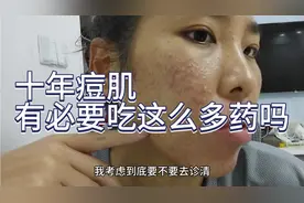 十年痘肌，有必要吃这么多药吗？只吃eva不知道可以不视频封面
