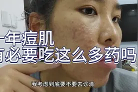 十年痘肌，有必要吃这么多药吗？只吃eva不知道可以不视频封面