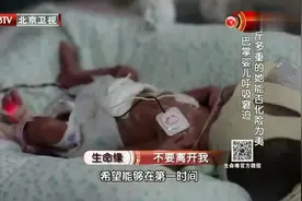 怀孕7月被迫生下巴掌大的婴儿，在医生细心呵护下终于顺利成长！