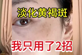 40岁阿姨长满脸斑。网上学到淡斑方法，在家偷偷的治好黄褐斑视频封面