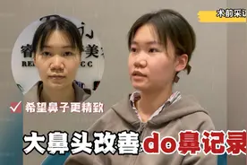 “两广鼻”女孩的缩鼻蜕变，从土气摇身变混血视频封面