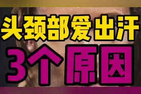 头颈多汗，发丝常被汗水打湿，揭秘3大诱因，教你有效止汗