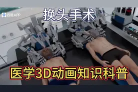 换头手术，医学3D动画知识科普视频封面