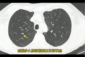 戒烟多久肺部能恢复正常视频封面