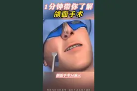 1分钟带你了解正颌手术视频封面