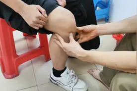 中医正骨现场直拍！ 警校大学生膝关节扭伤疼痛一年多正位调理。视频封面