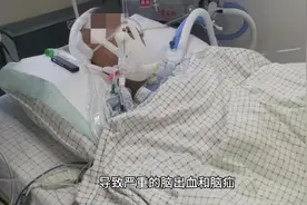 校园霸凌何时休？因为拒绝为同学写作业而遭受殴打致严重脑疝。