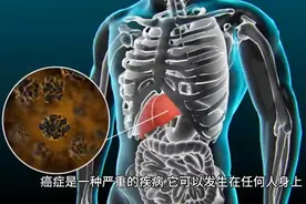 癌症 人类健康最大的威胁视频封面