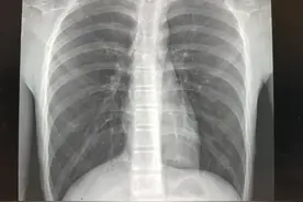 (一)照片和CT的区别视频封面