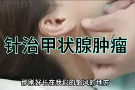 倪海厦老师针治甲状腺肿瘤视频封面