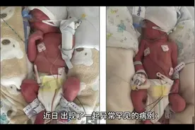 2个月大女宝突然变男宝视频封面
