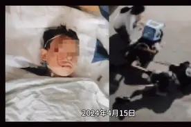 湖南9岁男孩不堪作业压力从高楼跳下视频封面