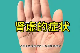 手纹上出现这些特征要注意！是肾虚的症状。