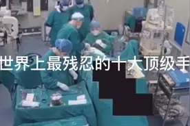 世界上最残忍的十大顶级手术你知道吗？视频封面