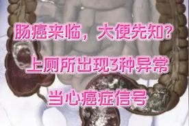 肠癌来临，大便先知？上厕所出现3种异常，可别忽视了视频封面